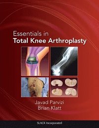 bokomslag Essentials in Total Knee Arthroplasty
