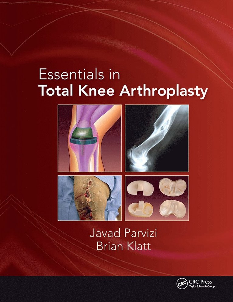 Javad Parvizi, Brian Klatt - Essentials in Total Knee Arthroplasty, Inbunden