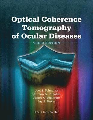 Optical Coherence Tomography of Ocular Diseases 1