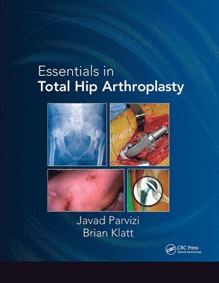 bokomslag Essentials in Total Hip Arthroplasty