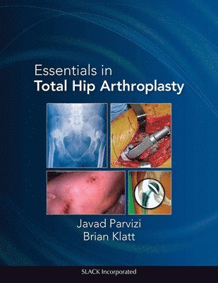Essentials in Total Hip Arthroplasty 1