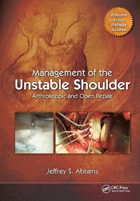 Management of the Unstable Shoulder 1