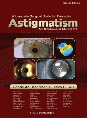 bokomslag A Complete Surgical Guide for Correcting Astigmatism