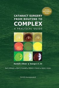 bokomslag Cataract Surgery from Routine to Complex