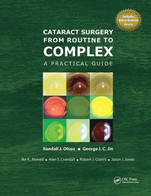 bokomslag Cataract Surgery from Routine to Complex