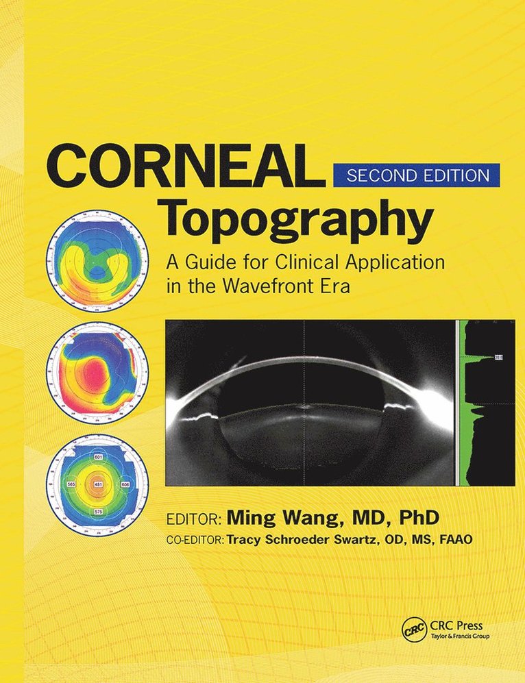 Ming Wang, Ph.D. Wang, Ming, M.D. - Corneal Topography, Inbunden