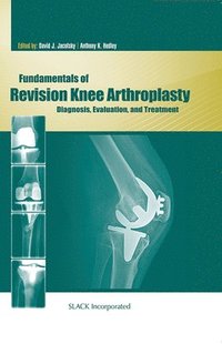 bokomslag Fundamentals of Revision Knee Arthroplasty