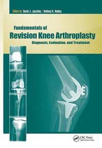 bokomslag Fundamentals of Revision Knee Arthroplasty