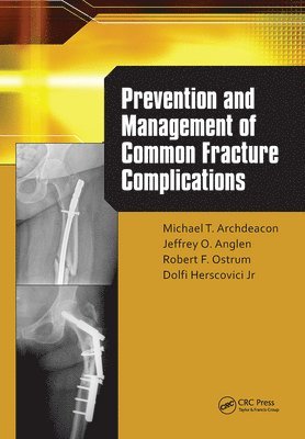 bokomslag Prevention and Management of Common Fracture Complications