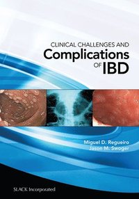 bokomslag Clinical Challenges and Complications of IBD