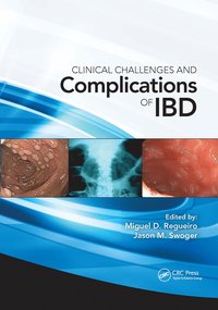 bokomslag Clinical Challenges and Complications of IBD