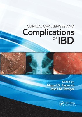 Clinical Challenges and Complications of IBD 1