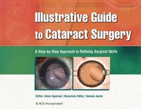 bokomslag Illustrative Guide to Cataract Surgery