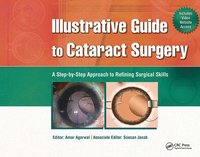 bokomslag Illustrative Guide to Cataract Surgery