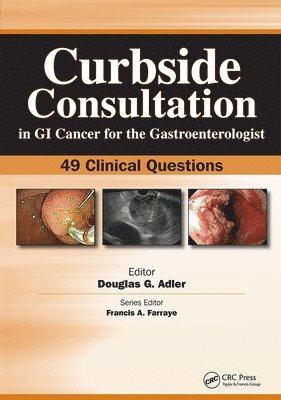 Curbside Consultation in GI Cancer for the Gastroenterologist 1