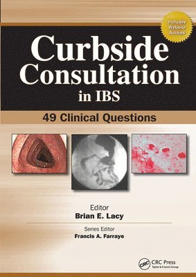 Curbside Consultation in IBS 1