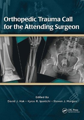 bokomslag Orthopedic Trauma Call for the Attending Surgeon