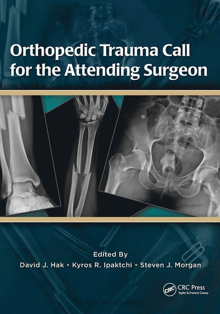 David Hak, Kyros Ipaktchi, Steven Morgan - Orthopedic Trauma Call for the Attending Surgeon, Häftad