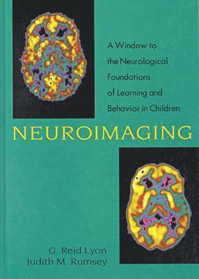 Neuroimaging 1