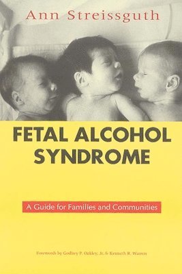 bokomslag Fetal Alcohol Syndrome