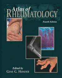 bokomslag Atlas of Rheumatology