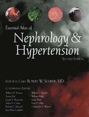 bokomslag Essential Atlas of Nephrology & Hypertension
