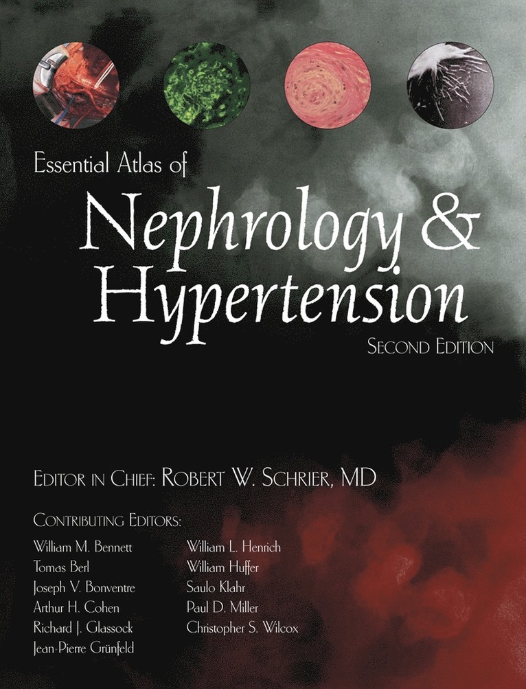 Robert W. Schrier, Robert W Schrier - Essential Atlas of Nephrology & Hypertension, Inbunden