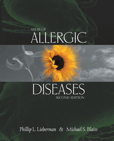 Phillip L. Lieberman, Michael S. Blaiss - Atlas of Allergic Diseases, Inbunden
