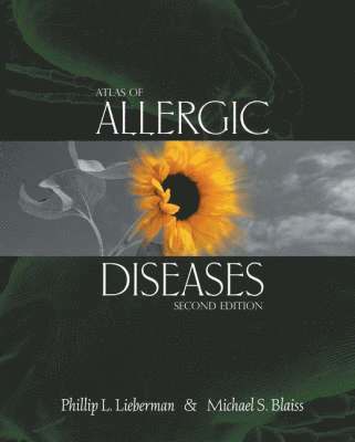 bokomslag Atlas of Allergic Diseases