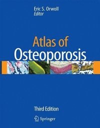 bokomslag Atlas of Osteoporosis