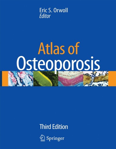 bokomslag Atlas of Osteoporosis