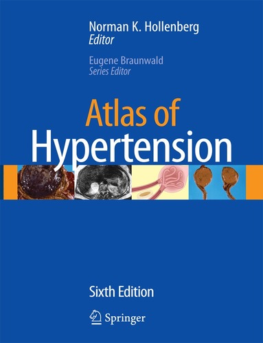 Norman K. Hollenberg - Atlas of Hypertension, Inbunden