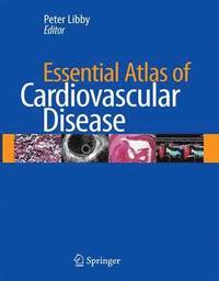 bokomslag Essential Atlas of Cardiovascular Disease