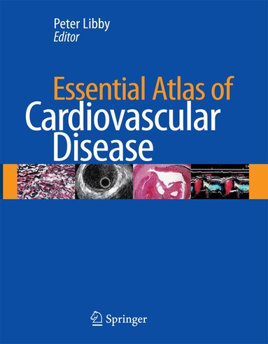 Peter Libby - Essential Atlas of Cardiovascular Disease, Inbunden