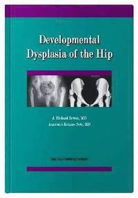 bokomslag Developmental Dysplasia of the Hip