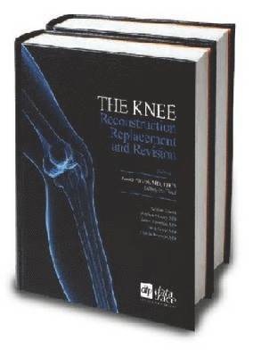 The Knee 1
