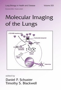 bokomslag Molecular Imaging of the Lungs