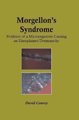 Morgellon's Syndrome 1