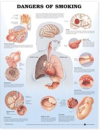 bokomslag Dangers of Smoking Anatomical Chart