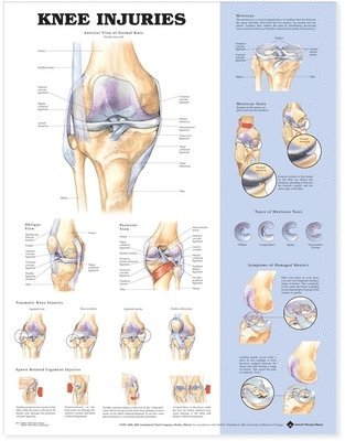 Knee Injuries Anatomical Chart 1