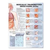 bokomslag Sexually Transmitted Infections (stis) Chart