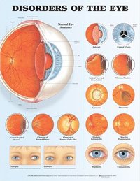 bokomslag Disorders of the Eye Anatomical Chart