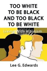bokomslag Too White to be Black and Too Black to be White