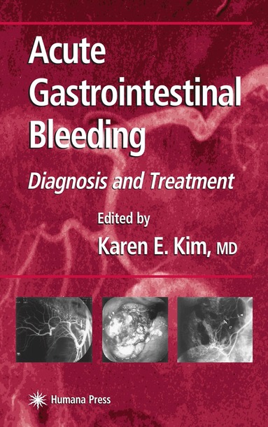 Karen E. Kim - Acute Gastrointestinal Bleeding, Inbunden