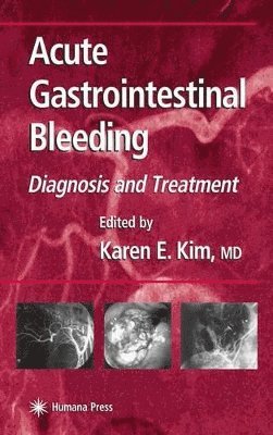 bokomslag Acute Gastrointestinal Bleeding