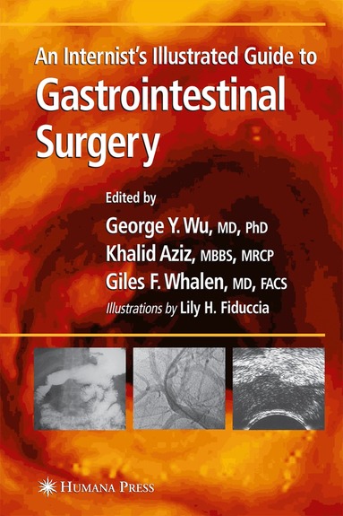 George Y. Wu - Internist’s Illustrated Guide to Gastrointestinal Surgery, Inbunden