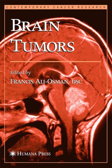 Francis Ali-Osman - Brain Tumors, Inbunden
