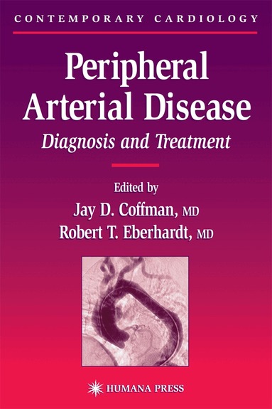 Jay D. Coffman, Robert T. Eberhardt - Peripheral Arterial Disease, Inbunden