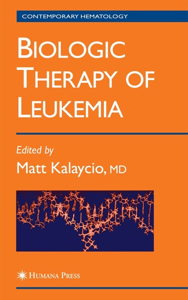 Matt Kalaycio - Biologic Therapy of Leukemia, Inbunden