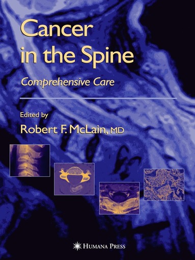 Robert F. McLain, Robert F. McLain, Maurie Markman, Ronald M. Bukowski, Roger Macklis, Edward C. Benzel - Cancer in the Spine, Inbunden